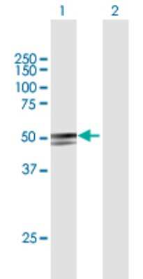 Western Blot: ANKDD1A Antibody [H00348094-B01P]