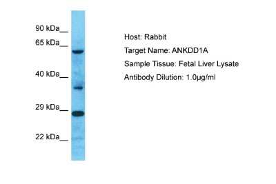 Western Blot: ANKDD1A Antibody [NBP2-84425]