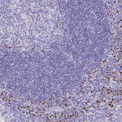 Immunohistochemistry-Paraffin: ANKDD1B Antibody [NBP2-32490]