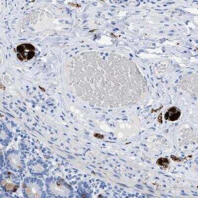 Immunohistochemistry-Paraffin: ANKFN1 Antibody [NBP1-93804]