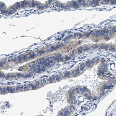 Immunohistochemistry-Paraffin: ANKFN1 Antibody [NBP1-93803]