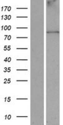 Western Blot: ANKFN1 Overexpression Lysate [NBP2-05276]