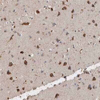 Immunohistochemistry-Paraffin: ANKFY1 Antibody [NBP1-89084]