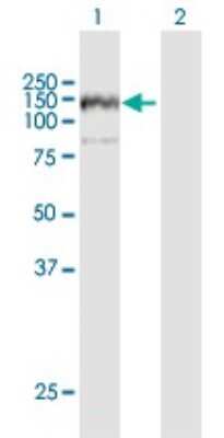 Western Blot: ANKFY1 Antibody [H00051479-B01P]