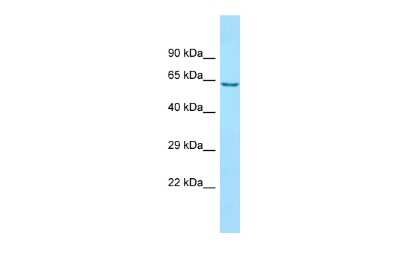 Western Blot: ANKFY1 Antibody [NBP3-10699]