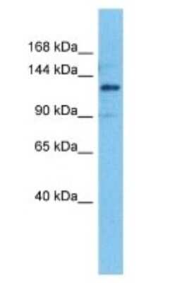 Western Blot: ANKFY1 Antibody [NBP3-10700]