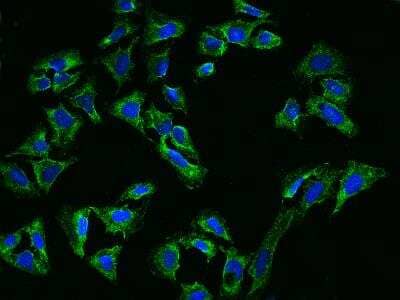 Immunocytochemistry/ Immunofluorescence: ANKH Antibody [NBP3-06185]