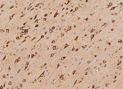 Immunohistochemistry-Paraffin: ANKH Antibody [NBP3-06185]