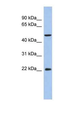 Western Blot: ANKH Antibody [NBP1-59748]