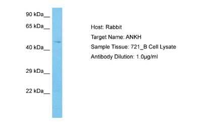 Western Blot: ANKH Antibody [NBP2-84426]