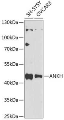 Western Blot: ANKH AntibodyBSA Free [NBP2-92843]