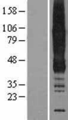 Western Blot: ANKH Overexpression Lysate [NBL1-07530]