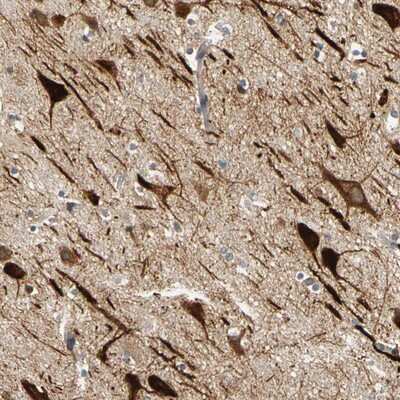 Immunohistochemistry-Paraffin: ANKHD1 Antibody [NBP1-84650]