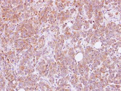 Immunohistochemistry-Paraffin: ANKHD1 Antibody [NBP2-15395]
