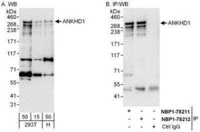 Western Blot: ANKHD1 Antibody [NBP1-78211]