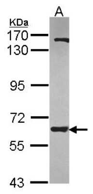 Western Blot: ANKHD1 Antibody [NBP2-15395]