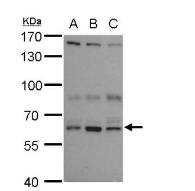 Western Blot: ANKHD1 Antibody [NBP2-15395]