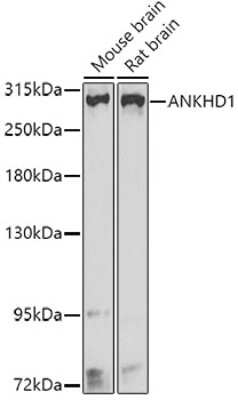 Western Blot: ANKHD1 AntibodyBSA Free [NBP2-92533]