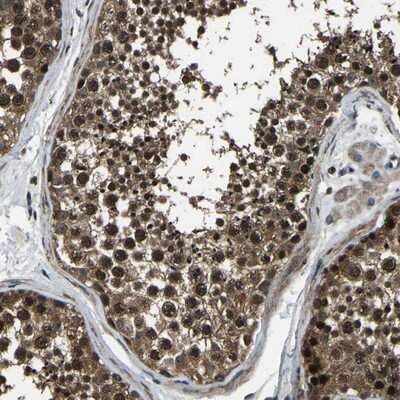 Immunohistochemistry-Paraffin: ANKIB1 Antibody [NBP1-85150]