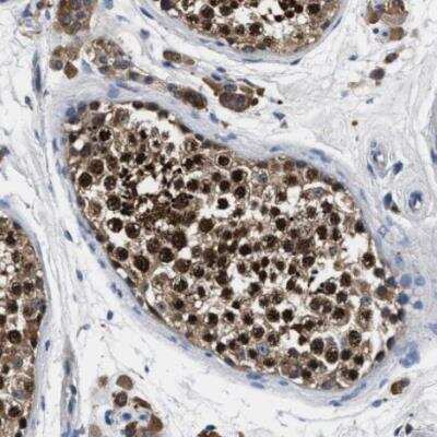 Immunohistochemistry-Paraffin: ANKIB1 Antibody [NBP2-47548]