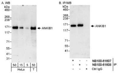 Western Blot: ANKIB1 Antibody [NB100-61608]