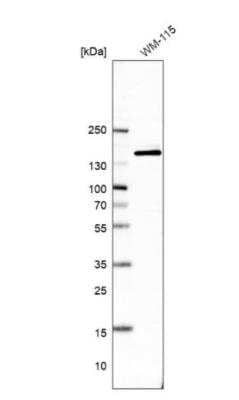 Western Blot: ANKIB1 Antibody [NBP2-47548]