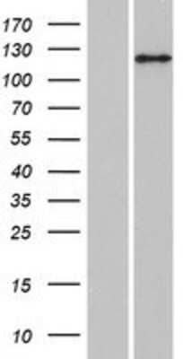 Western Blot: ANKIB1 Overexpression Lysate [NBP2-06748]