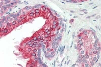 Immunohistochemistry-Paraffin: ANKK1 Antibody [NBP1-28459]