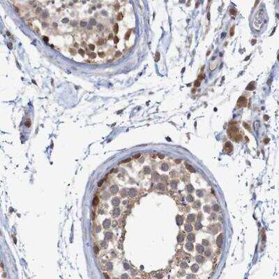 Immunohistochemistry-Paraffin: ANKK1 Antibody [NBP1-86849]