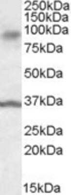 Western Blot: ANKK1 Antibody [NBP1-28459]