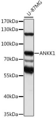 Western Blot: ANKK1 AntibodyAzide and BSA Free [NBP2-92306]