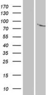 Western Blot: ANKK1 Overexpression Lysate [NBP2-04958]