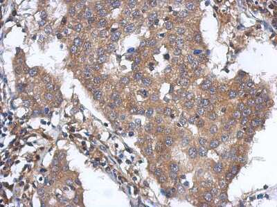Immunohistochemistry-Paraffin: ANKLE2 Antibody [NBP2-15396]