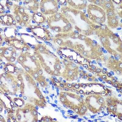 Immunohistochemistry-Paraffin: ANKLE2 Antibody - Azide and BSA Free [NBP2-92367]