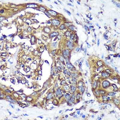 Immunohistochemistry-Paraffin: ANKLE2 Antibody - Azide and BSA Free [NBP2-92367]