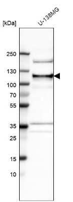 Western Blot: ANKLE2 Antibody [NBP1-82970]