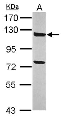 Western Blot: ANKLE2 Antibody [NBP2-15396]