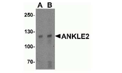 Western Blot: ANKLE2 AntibodyBSA Free [NBP2-41145]