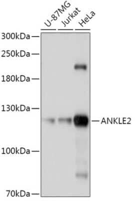 Western Blot: ANKLE2 AntibodyAzide and BSA Free [NBP2-92367]