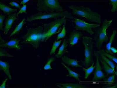 Immunocytochemistry/ Immunofluorescence: ANKMY1 Antibody [H00051281-B01P]