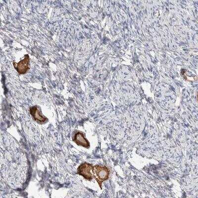 Immunohistochemistry-Paraffin: ANKMY1 Antibody [NBP1-82179]