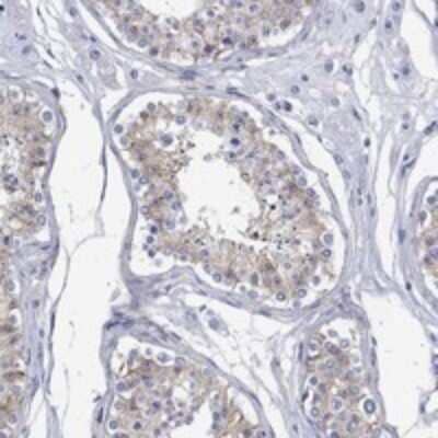 Immunohistochemistry-Paraffin: ANKMY1 Antibody [NBP3-17340]