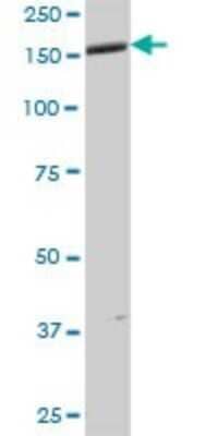 Western Blot: ANKMY1 Antibody [H00051281-B01P]