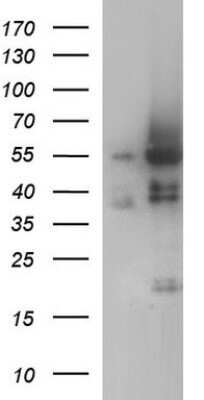 Western Blot: ANKMY2 Antibody (OTI1F11) [NBP2-46524]