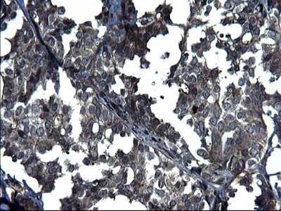 Immunohistochemistry: ANKMY2 Antibody (OTI1F11) - Azide and BSA Free [NBP2-72073]