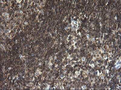 Immunohistochemistry: ANKMY2 Antibody (OTI1F11) - Azide and BSA Free [NBP2-72073]