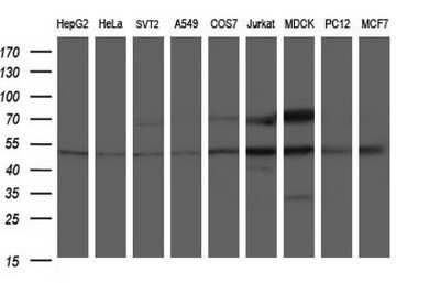 Western Blot: ANKMY2 Antibody (OTI1F11)Azide and BSA Free [NBP2-72073]