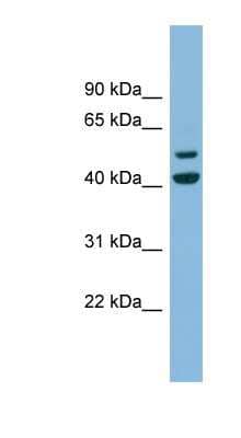 Western Blot: ANKMY2 Antibody [NBP1-55412]