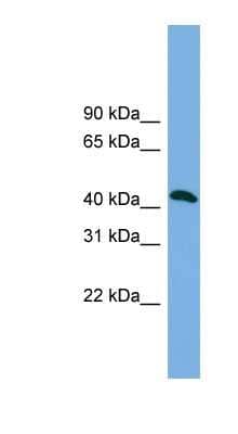 Western Blot: ANKMY2 Antibody [NBP1-56599]