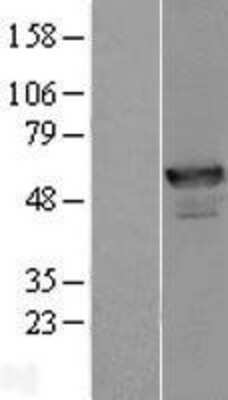 Western Blot: ANKMY2 Overexpression Lysate [NBL1-07531]